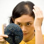 Anemia Hair Fall
