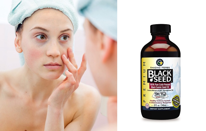 Black Seed Oil For Dark Circles