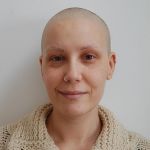 Chemotherapy and Radiotherapy