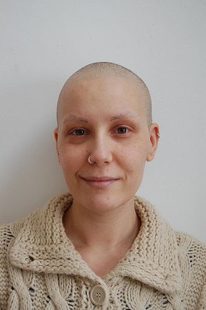 Chemotherapy and Radiotherapy