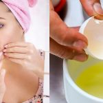 Egg White For Acne
