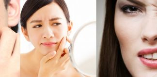 How to get rid of pimples at home