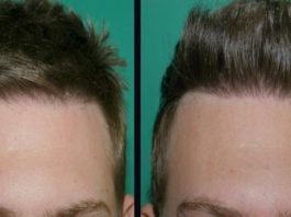 Increase Hair Density after a Haircut