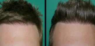 Increase Hair Density after a Haircut