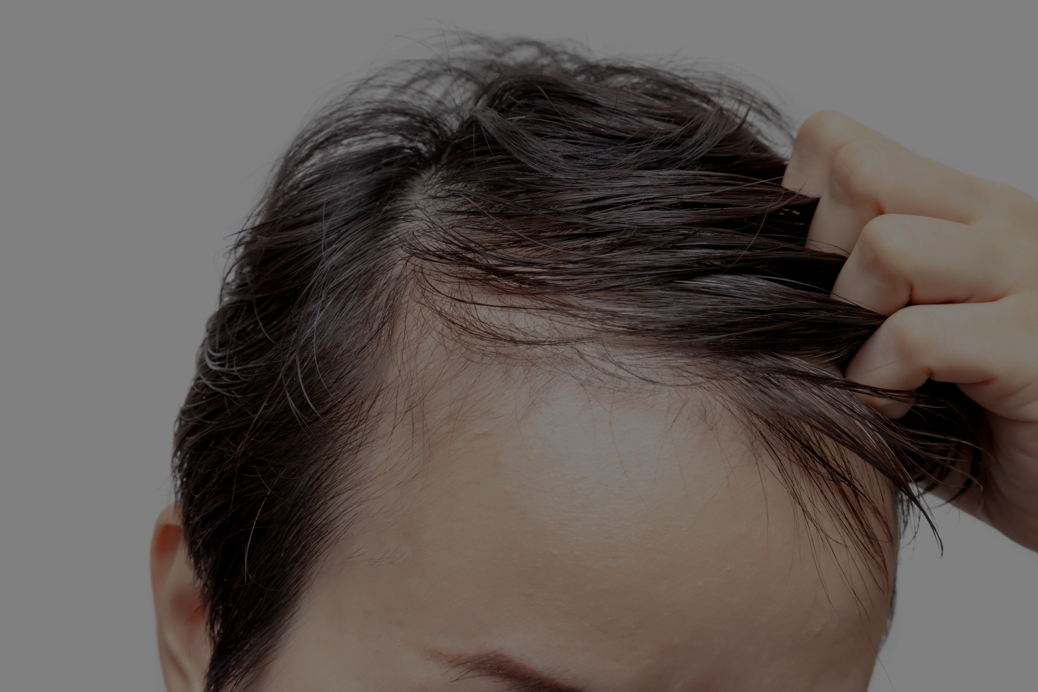 lifestyle adjustment for increase hair density