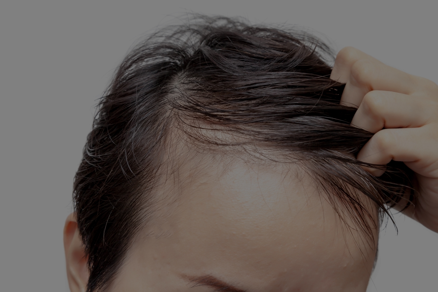 Scalp Ink Design  Add hair density to your scalp with SMP  Say  goodbye to problems like male pattern baldness receding hairline  thinning hair bald spots scalpmicropigmentation balding thinninghair  hairtattoo barber 